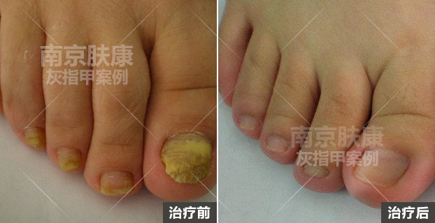 1510909253132920.jpg h3.jpg