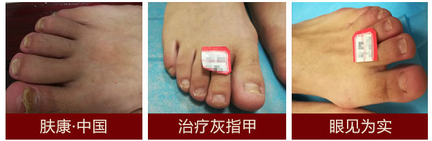 1514101305613202.jpg 1_meitu_3.jpg