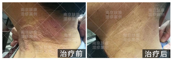 1516171323177290.jpg 600.jpg