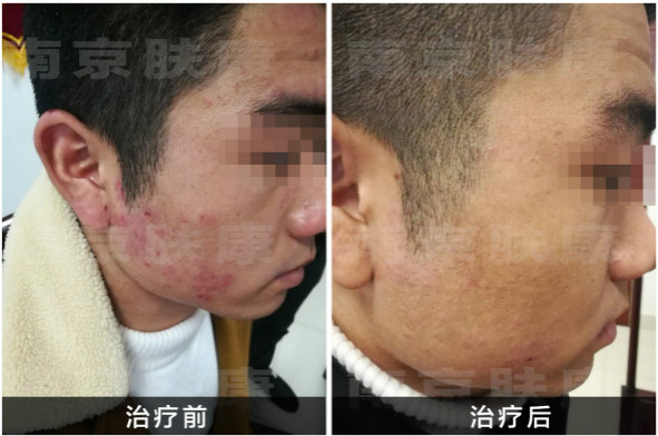 1517465789465948.jpg 未命名_meitu_1.jpg