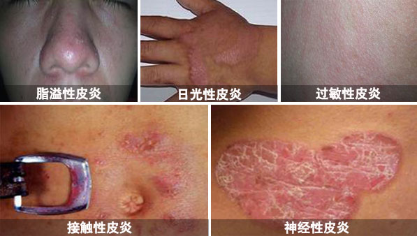 1519884305306558.jpg py1.jpg