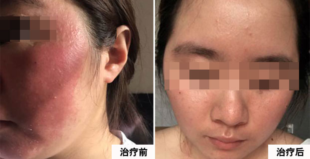 1519888644120291.jpg gm1.jpg