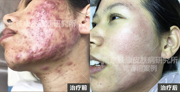 1513742073126410.jpg 003.jpg