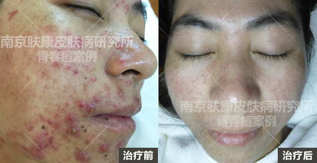 1513742080750990.jpg 002.jpg