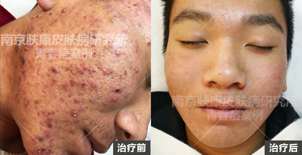 1513742098645820.jpg 001.jpg