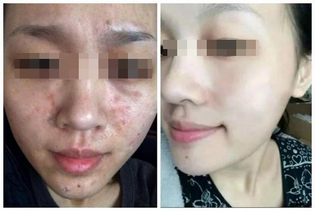 1513648368763211.jpg 1482735458337_0.jpg