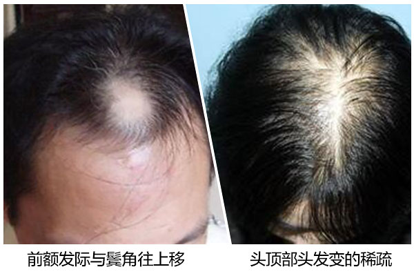 1521768717124189.jpg 600-400(1).jpg