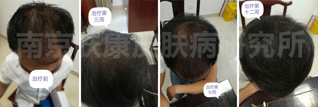 1521883749146560.jpg 1-1501201341142K.jpg