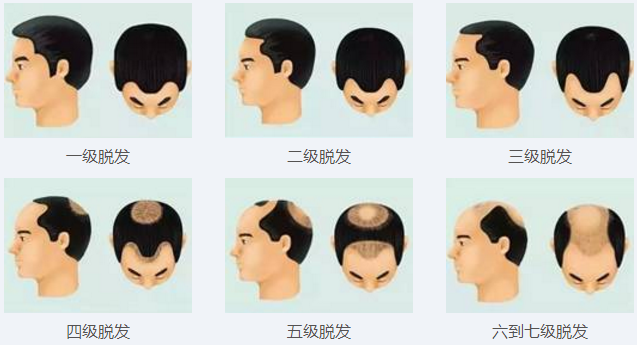 1522477476134319.png 913.png