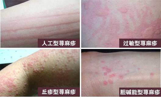 1522804431104605.jpg 1522659297711444.jpg