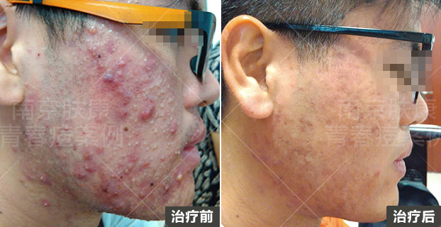 1524031279103267.jpg 1510908830114731(1).jpg