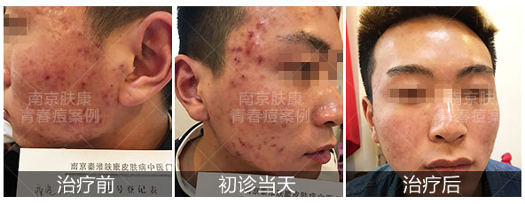 1524032236376700.jpg day(2).jpg