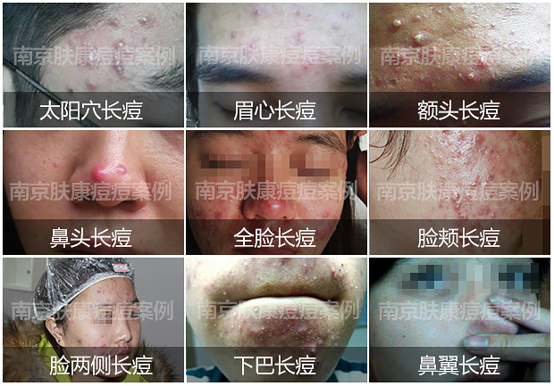 1524795291217525.jpg 640-1.jpg