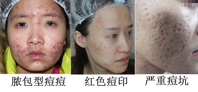 1524812423651931.jpg 未标题-1.jpg