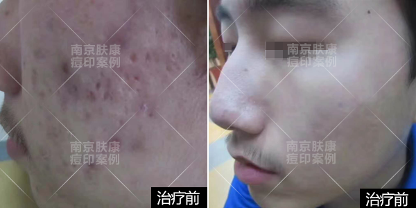 1524813050137697.png 1-1.png