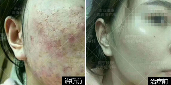 1524813152220623.png 1-2.png