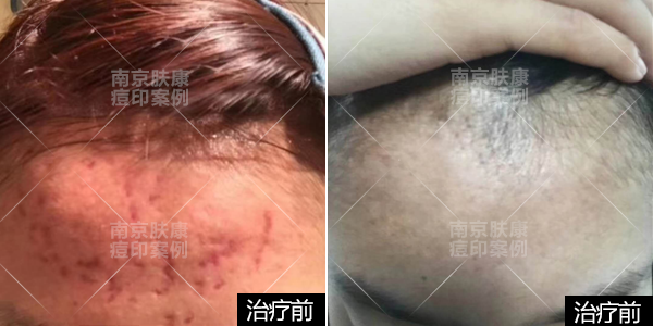 1524813284117722.png 1-3.png