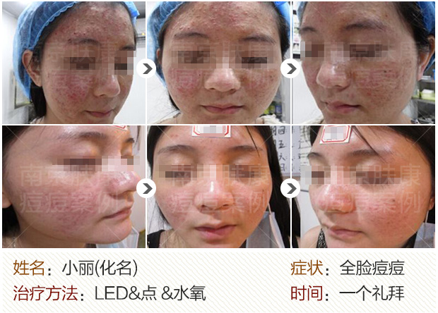 1525077228133962.jpg 620--.jpg