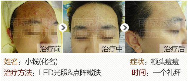 1525077332188134.jpg 620-1.jpg