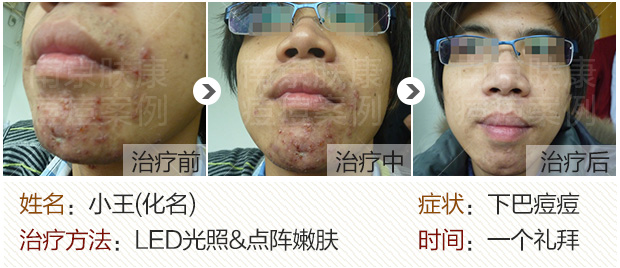 1525077460112140.jpg 620-3.jpg