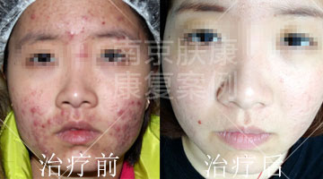 1525078107277038.jpg 1.jpg