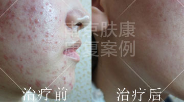 1525078123111620.jpg 1-8.jpg