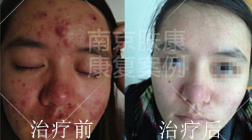 1525078144982071.jpg 1-6.jpg