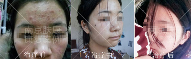 1525079163711659.jpg 02.jpg