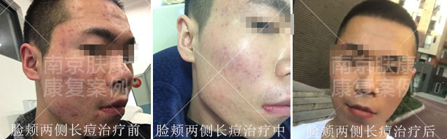 1525079191911757.jpg 01.jpg