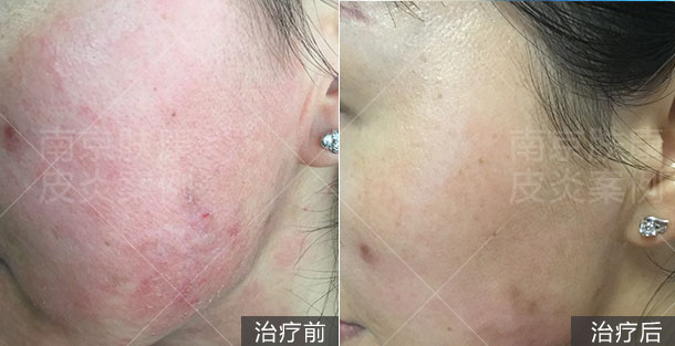 1510906852521760.jpg 1510906852521760.jpg