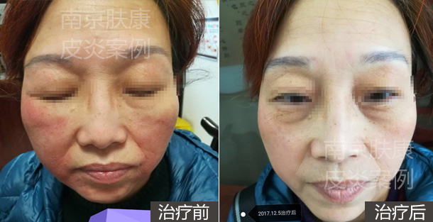 1510906852521760.jpg 1510906852521760.jpg